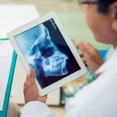 Radiografía lateral de cráneo