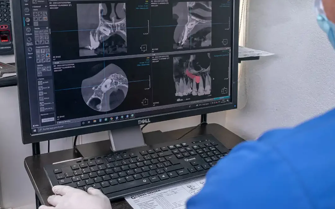Equipo de Tomografía Dental 3D en Quito