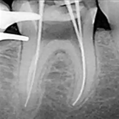 70-Conductometria-digital-en-quito-ecuador Conductometría digital en quito ecuador